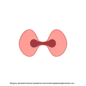 Купить Модуль автоматической разметки патологий маммографических исследований - ARPP-13482 из реестра по лучшей цене