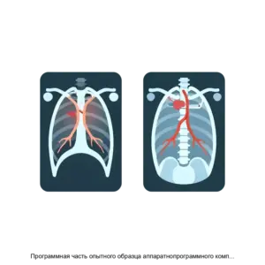 Купить Программная часть опытного образца аппаратнопрограммного комплекса Интеллектуальная система поддержки врачебных решений на основе технологий искусственного интеллекта - ARPP-21582 из реестра по лучшей цене