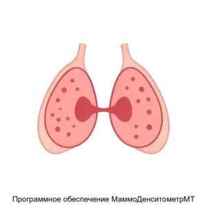 Купить Программное обеспечение МаммоДенситометрМТ - ARPP-21943 из реестра по лучшей цене