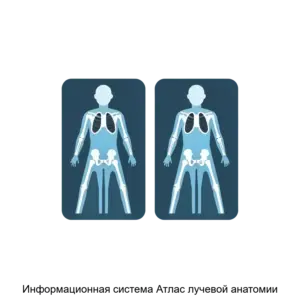 Купить Информационная система Атлас лучевой анатомии - ARPP-25651 из реестра по лучшей цене