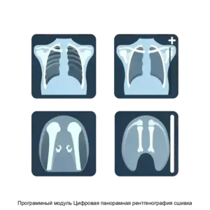 Купить Программный модуль Цифровая панорамная рентгенография сшивка - ARPP-13204 из реестра по лучшей цене