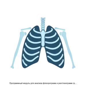 Купить Программный модуль для анализа флюорограмм и рентгенограмм грудной клетки человека - MKS-PLAT-22294 из реестра по лучшей цене