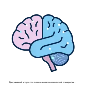 Купить Программный модуль для анализа магнитнорезонансной томографии головного мозга человека - MKS-PLAT-23164 из реестра по лучшей цене