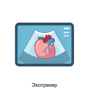 Купить Эхотрекер - ARPP-30832 из реестра по лучшей цене