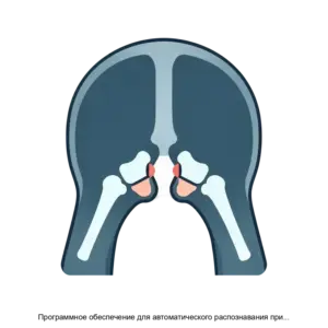 Купить Программное обеспечение для автоматического распознавания признаков синуситов с применением технологий искусственного интеллекта AI RADIOLOGY SXR - ARPP-30224 из реестра по лучшей цене
