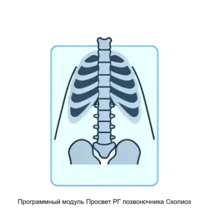 Купить Программный модуль Просвет РГ позвоночника Сколиоз - ARPP-30065 из реестра по лучшей цене